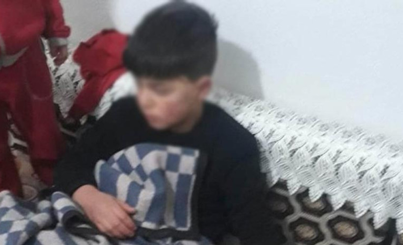 Konya'da ırkçı saldırı: Çocuğun kolunu kırdılar