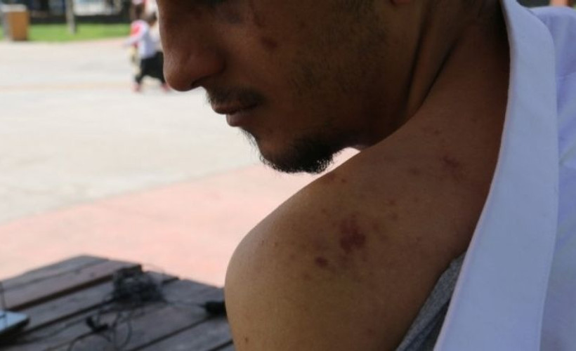 Taksim'de polis şiddetine uğrayan Kürt genç: 'Şikayet etme sicilin bozulur' dediler