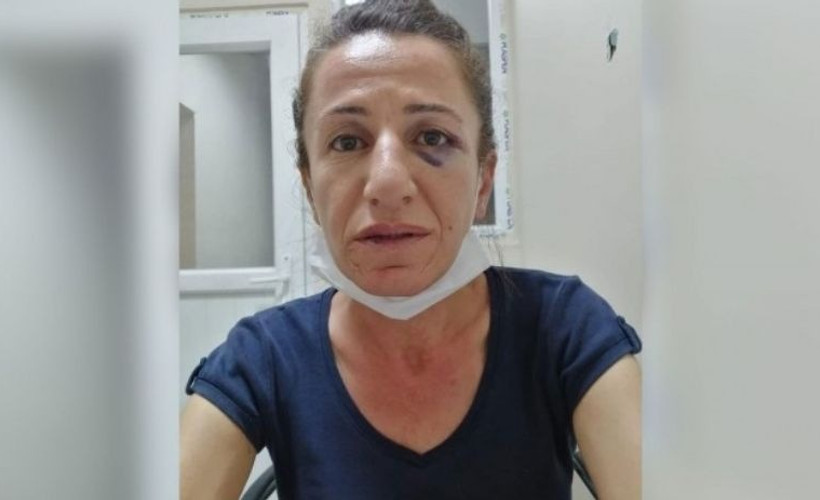 Gözaltına alınırken köpek saldırısına uğrayan Çetin tahliye edilmedi