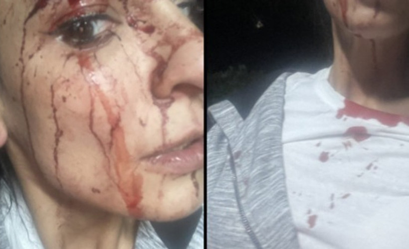 Evlerinin bahçesinde bira içen 6 kadın, erkeklerin saldırısına uğradı
