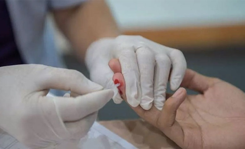 Türkiye’de son üç yılda HIV tanısı alan kişilerin sayısı 10 bine ulaştı