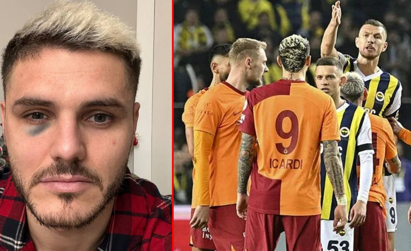 Galatasaray, Icardi'nin son halini paylaştı, Fenerbahçe'den yanıt geldi