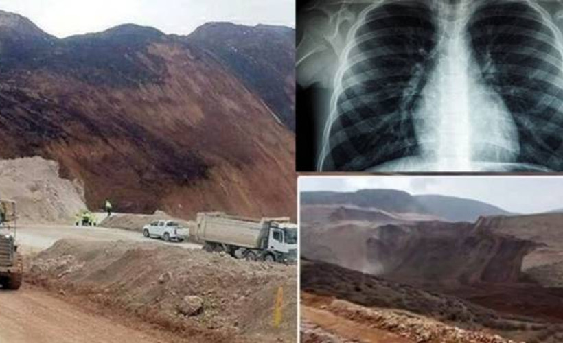 Türk Toraks Derneği endişeleri haklı çıkardı: Siyanür solunum yoluyla da zehirler