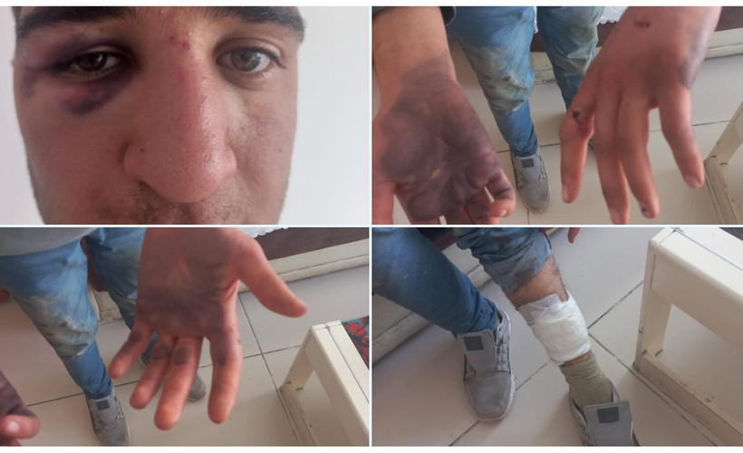 DEM Parti Gençlik Meclisi üyesine gözaltında işkence