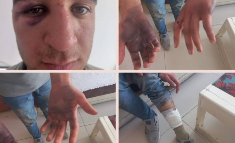 Gözaltında penseyle işkence edilmişti: DEM Partili Gezici'nin davasına açık tanık eklendi, tahliye edilmedi