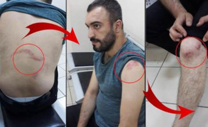 'Pantolon paçası' tartışmasından gözaltına alınıp darp edildi