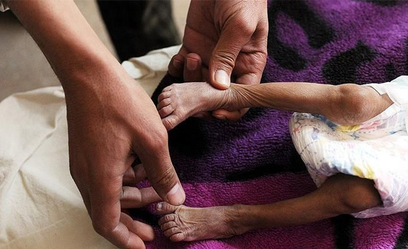 'Yemen'de 20 milyon insan açlıkla savaşıyor'