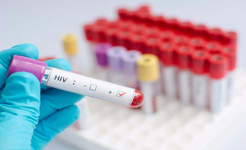 HIV virüsü artık hemen öldüremiyor