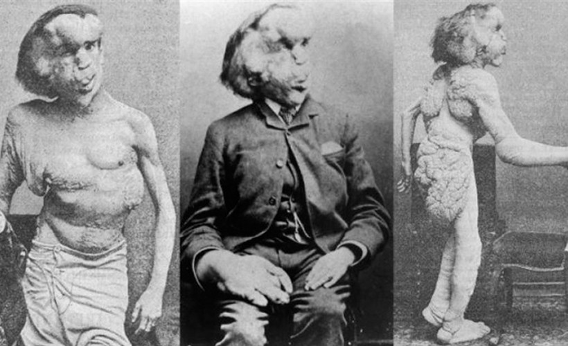 Fil Adam Joseph Merrick'in mezarı bulundu iddiası