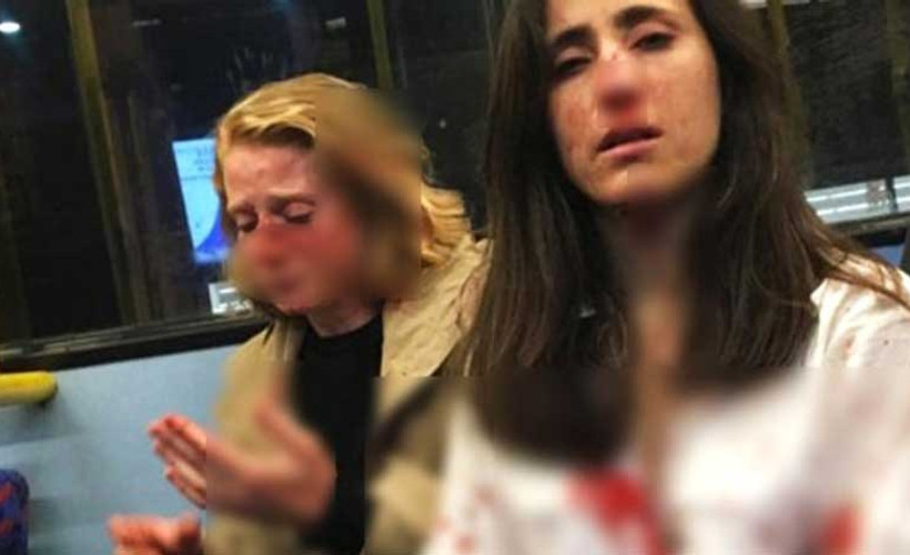 Lezbiyen çift otobüste 4 erkek tarafından dövüldü