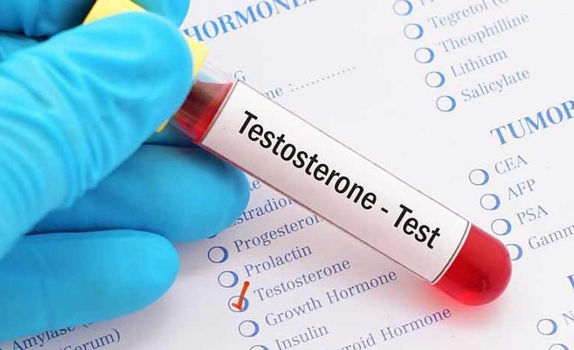 'Testosteren hormonu yüksek seviyede olan erkekler 'agresif ve çıkarcı' davranışlar sergiliyor'