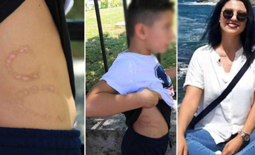 Küçük çocuğa 'işkence' yapan anne ve sevgilisi tutuklandı